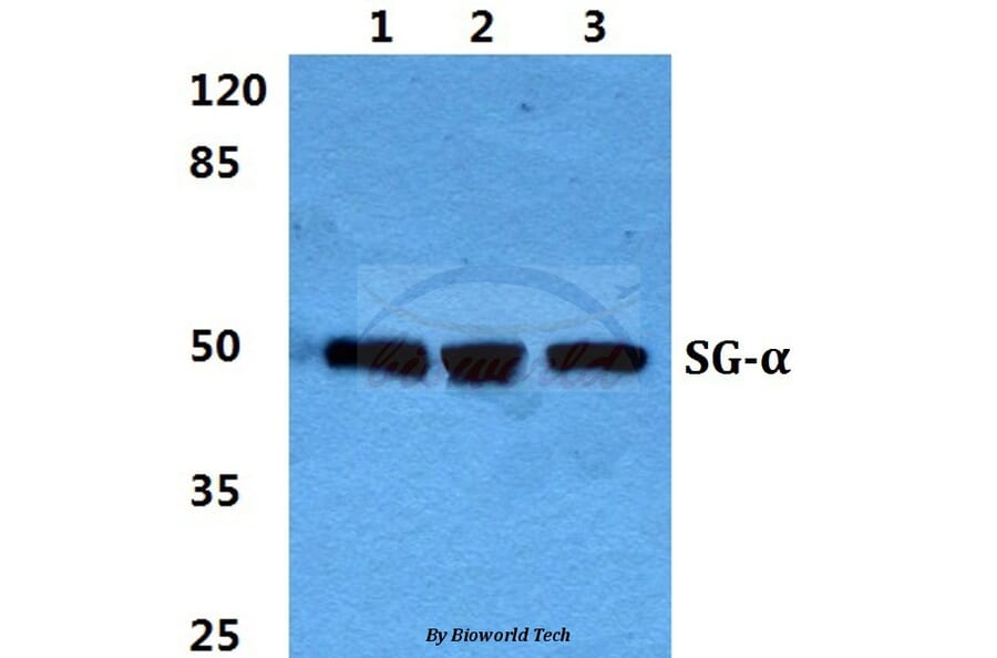 Anti-Sarcoglycan-α Antibody from Bioworld Technology (BS5920) - Antibodies.com