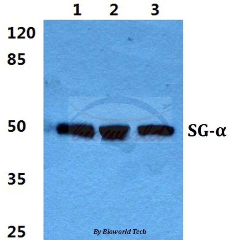 Anti-Sarcoglycan-α Antibody from Bioworld Technology (BS5920) - Antibodies.com