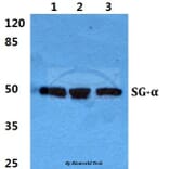 Anti-Sarcoglycan-α Antibody from Bioworld Technology (BS5920) - Antibodies.com