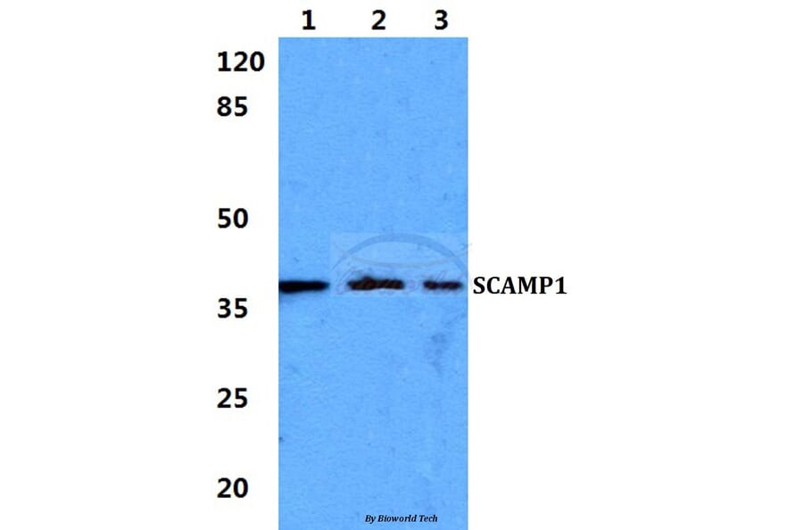 Anti-SCAMP1 Antibody from Bioworld Technology (BS5921) - Antibodies.com