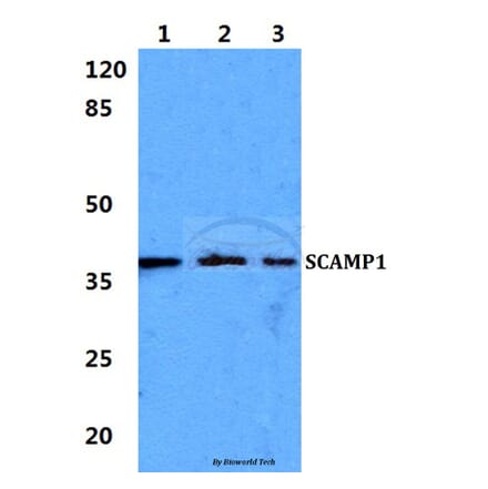 Anti-SCAMP1 Antibody from Bioworld Technology (BS5921) - Antibodies.com