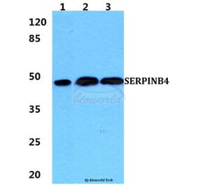 Anti-SERPINB4 Antibody from Bioworld Technology (BS5922) - Antibodies.com