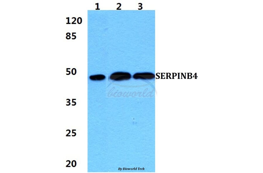 Anti-SERPINB4 Antibody from Bioworld Technology (BS5922) - Antibodies.com