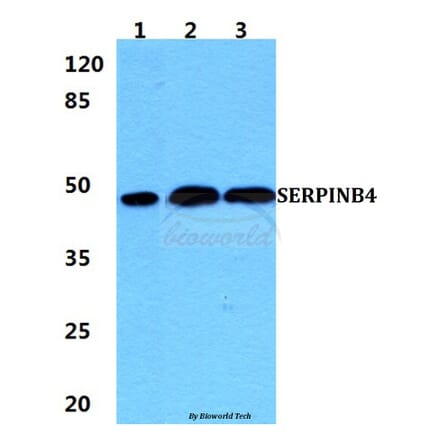 Anti-SERPINB4 Antibody from Bioworld Technology (BS5922) - Antibodies.com