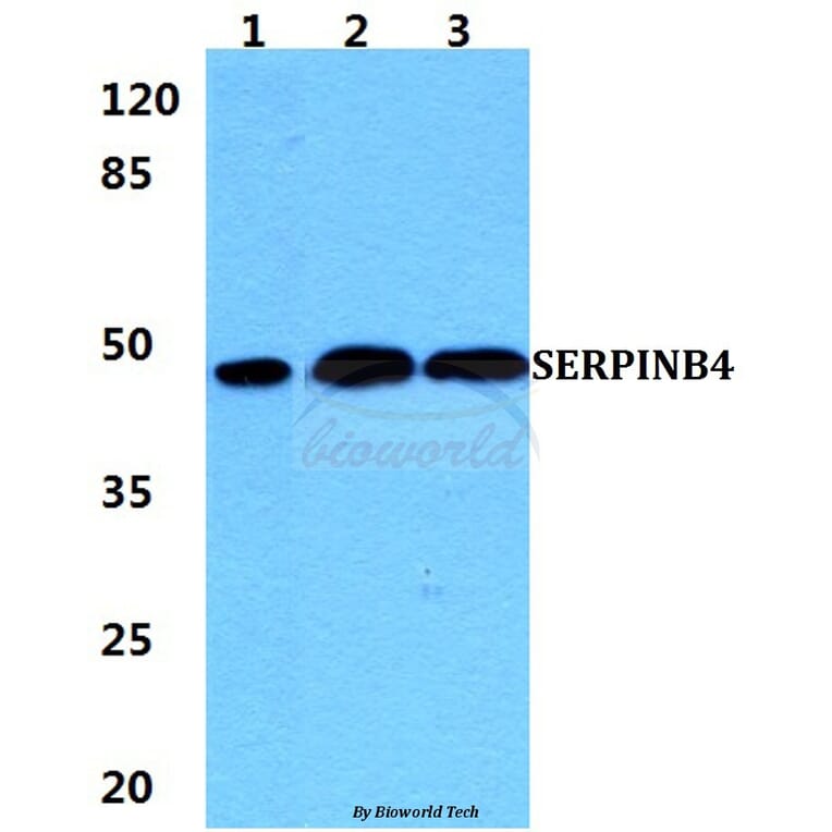 Anti-SERPINB4 Antibody from Bioworld Technology (BS5922) - Antibodies.com