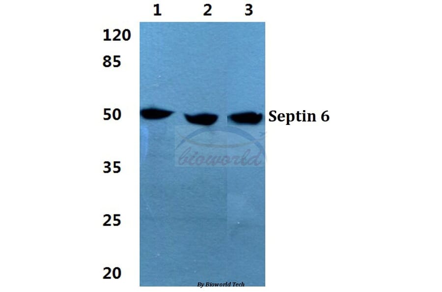 Anti-Septin 6 Antibody from Bioworld Technology (BS5925) - Antibodies.com