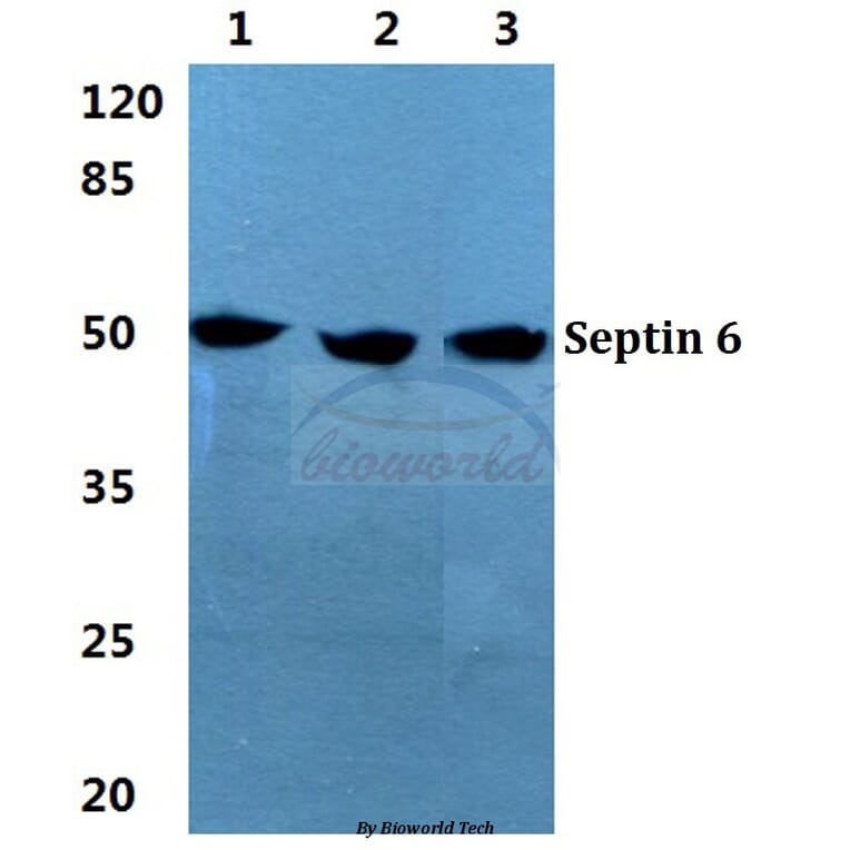 Anti-Septin 6 Antibody from Bioworld Technology (BS5925) - Antibodies.com