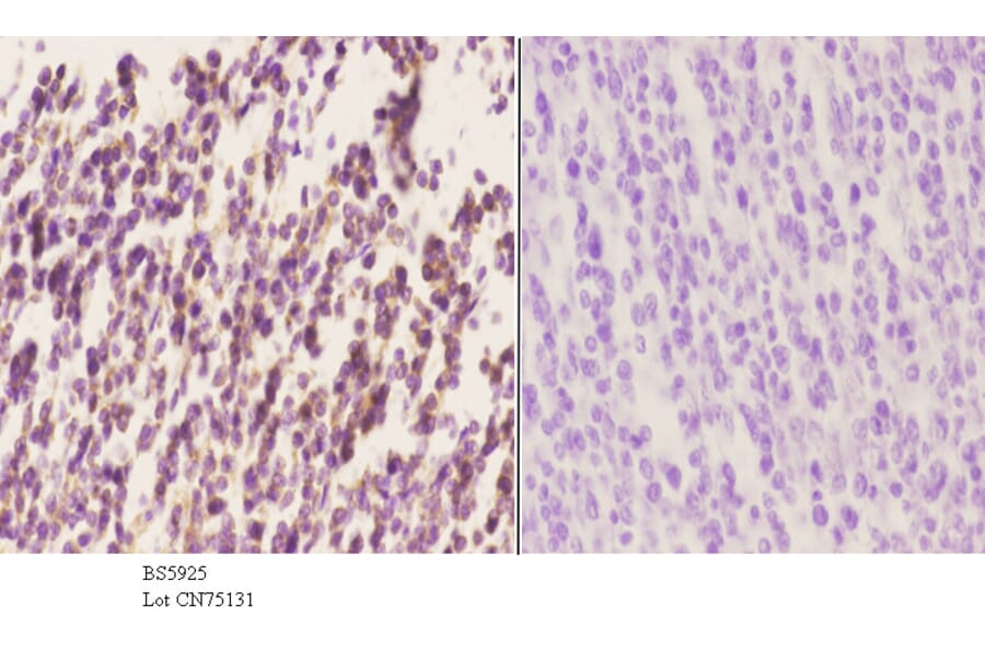 Anti-Septin 6 Antibody from Bioworld Technology (BS5925) - Antibodies.com