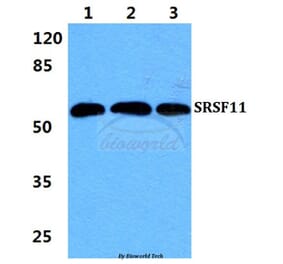 Anti-SRSF11 Antibody from Bioworld Technology (BS5927) - Antibodies.com