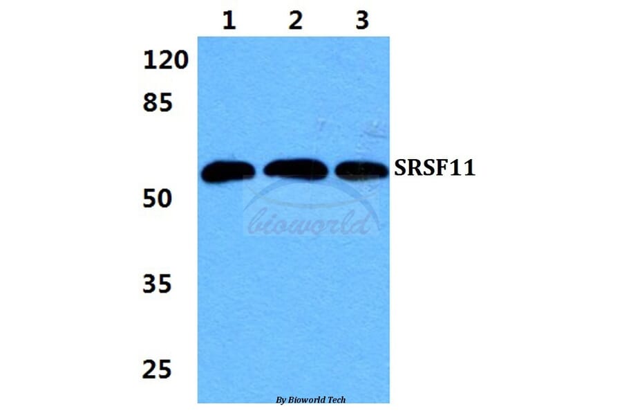 Anti-SRSF11 Antibody from Bioworld Technology (BS5927) - Antibodies.com