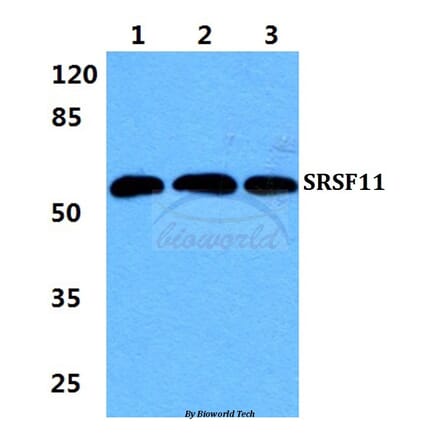 Anti-SRSF11 Antibody from Bioworld Technology (BS5927) - Antibodies.com