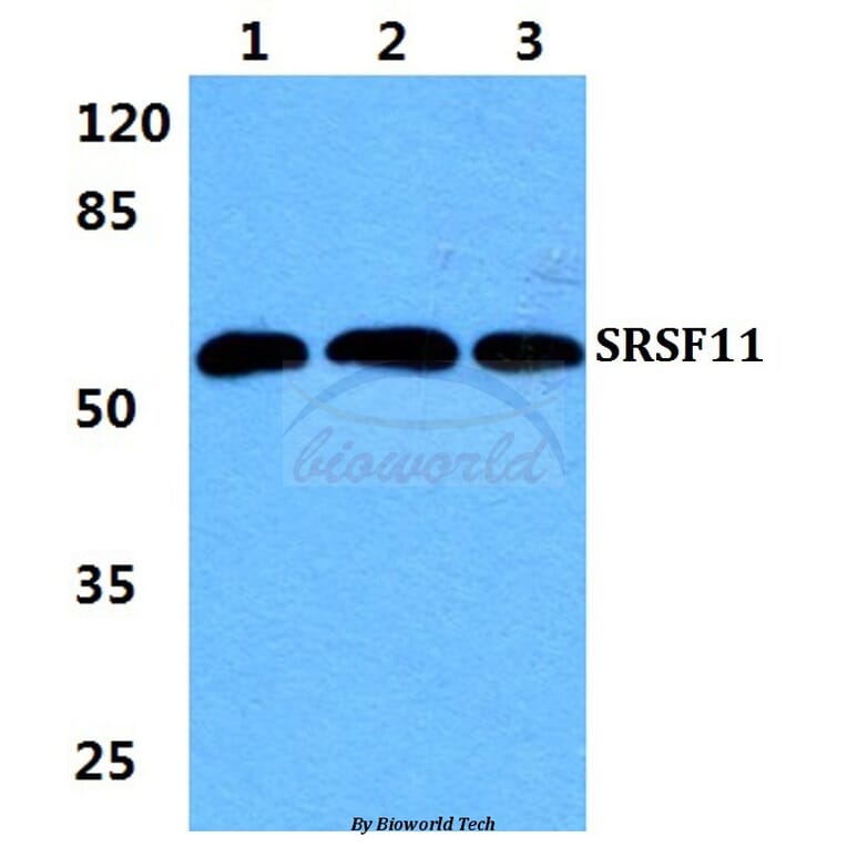 Anti-SRSF11 Antibody from Bioworld Technology (BS5927) - Antibodies.com