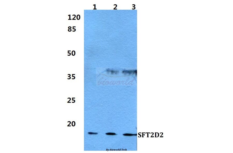 Anti-SFT2D2 Antibody from Bioworld Technology (BS5928) - Antibodies.com