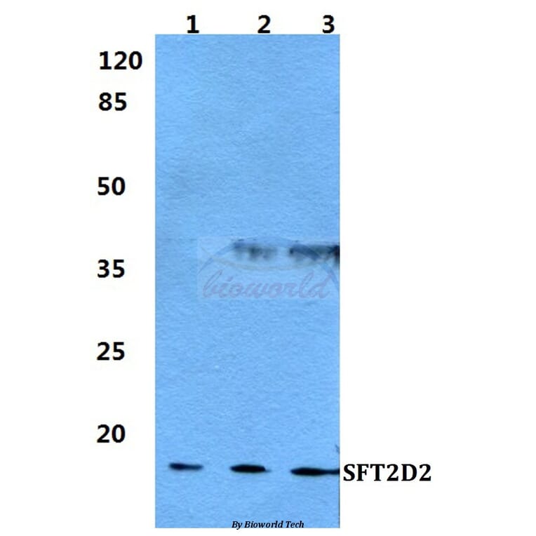 Anti-SFT2D2 Antibody from Bioworld Technology (BS5928) - Antibodies.com