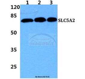 Anti-SLC5A2 Antibody from Bioworld Technology (BS5929) - Antibodies.com