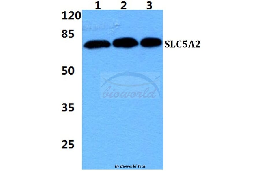 Anti-SLC5A2 Antibody from Bioworld Technology (BS5929) - Antibodies.com