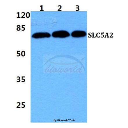 Anti-SLC5A2 Antibody from Bioworld Technology (BS5929) - Antibodies.com