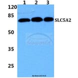 Anti-SLC5A2 Antibody from Bioworld Technology (BS5929) - Antibodies.com