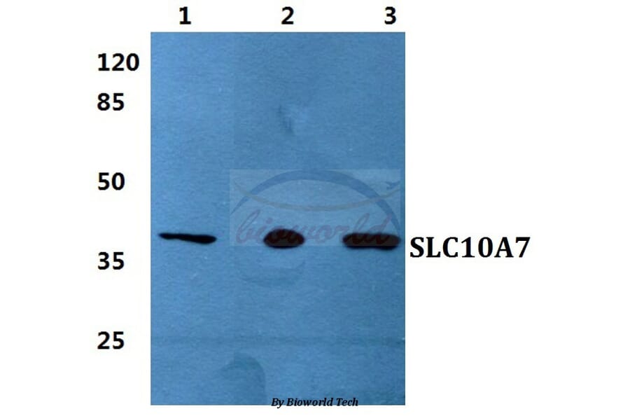 Anti-SLC10A7 Antibody from Bioworld Technology (BS5931) - Antibodies.com