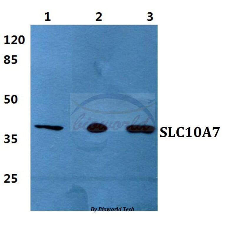 Anti-SLC10A7 Antibody from Bioworld Technology (BS5931) - Antibodies.com