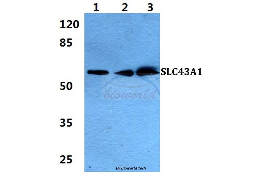 Anti-SLC43A1 Antibody from Bioworld Technology (BS5933) - Antibodies.com