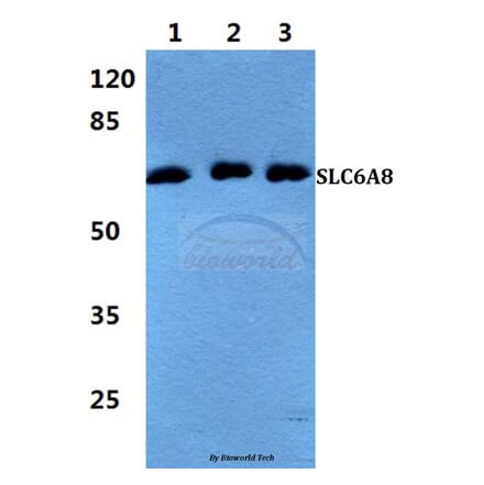 Anti-SLC6A8 Antibody from Bioworld Technology (BS5934) - Antibodies.com