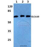 Anti-SLC6A8 Antibody from Bioworld Technology (BS5934) - Antibodies.com