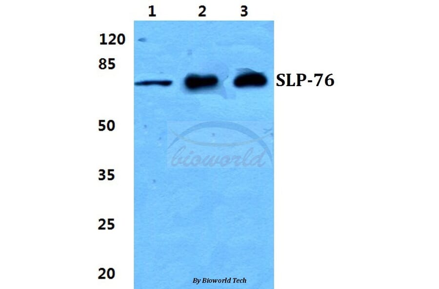 Anti-SLP-76 Antibody from Bioworld Technology (BS5935) - Antibodies.com