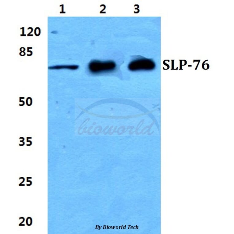 Anti-SLP-76 Antibody from Bioworld Technology (BS5935) - Antibodies.com