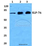 Anti-SLP-76 Antibody from Bioworld Technology (BS5935) - Antibodies.com