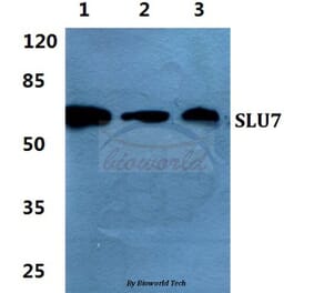 Anti-SLU7 Antibody from Bioworld Technology (BS5936) - Antibodies.com