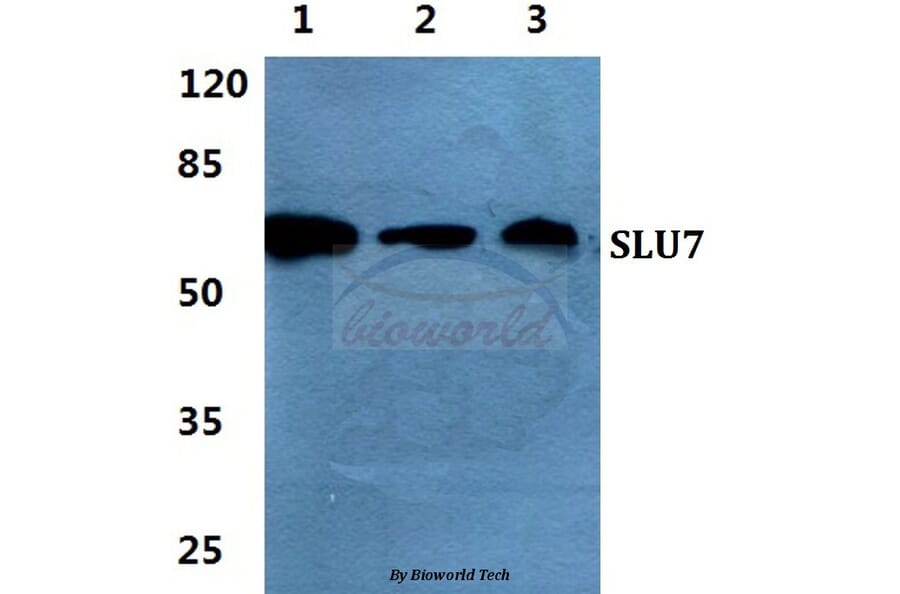 Anti-SLU7 Antibody from Bioworld Technology (BS5936) - Antibodies.com