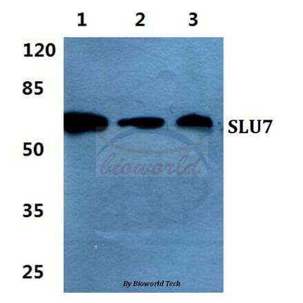 Anti-SLU7 Antibody from Bioworld Technology (BS5936) - Antibodies.com