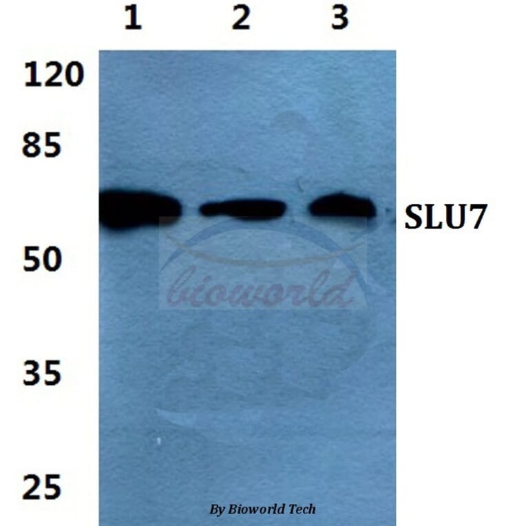 Anti-SLU7 Antibody from Bioworld Technology (BS5936) - Antibodies.com