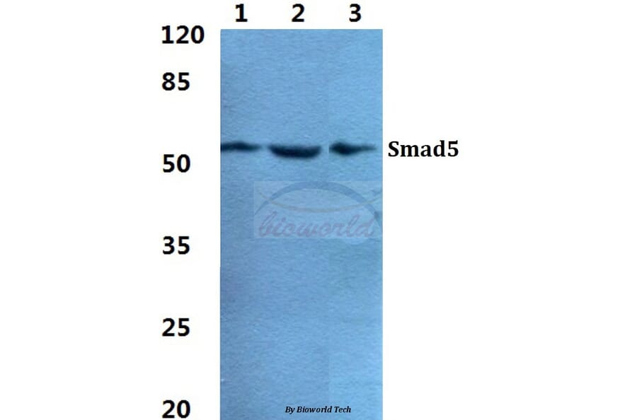 Anti-Smad5 Antibody from Bioworld Technology (BS5937) - Antibodies.com