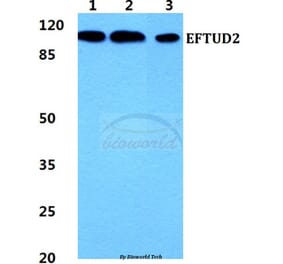 Anti-EFTUD2 Antibody from Bioworld Technology (BS5939) - Antibodies.com