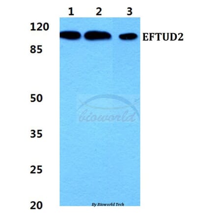 Anti-EFTUD2 Antibody from Bioworld Technology (BS5939) - Antibodies.com