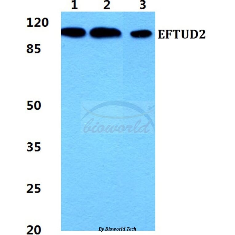 Anti-EFTUD2 Antibody from Bioworld Technology (BS5939) - Antibodies.com