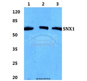 Anti-SNX1 Antibody from Bioworld Technology (BS5940) - Antibodies.com