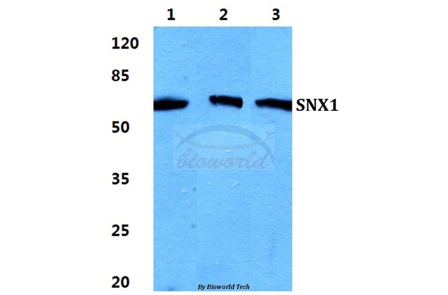Anti-SNX1 Antibody from Bioworld Technology (BS5940) - Antibodies.com