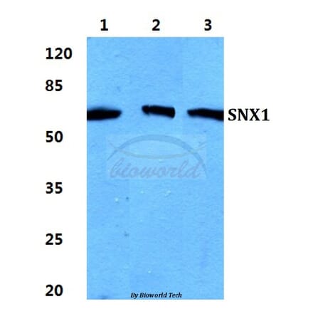 Anti-SNX1 Antibody from Bioworld Technology (BS5940) - Antibodies.com