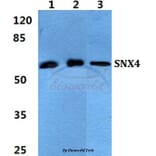 Anti-SNX4 Antibody from Bioworld Technology (BS5942) - Antibodies.com