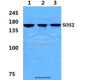 Anti-SOS2 Antibody from Bioworld Technology (BS5943) - Antibodies.com