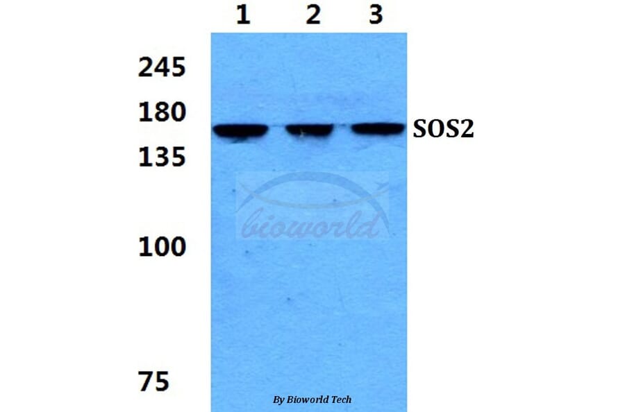 Anti-SOS2 Antibody from Bioworld Technology (BS5943) - Antibodies.com