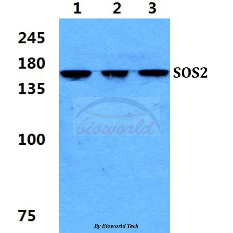 Anti-SOS2 Antibody from Bioworld Technology (BS5943) - Antibodies.com