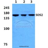 Anti-SOS2 Antibody from Bioworld Technology (BS5943) - Antibodies.com