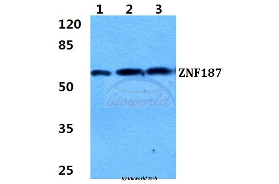 Anti-ZNF187 Antibody from Bioworld Technology (BS5945) - Antibodies.com