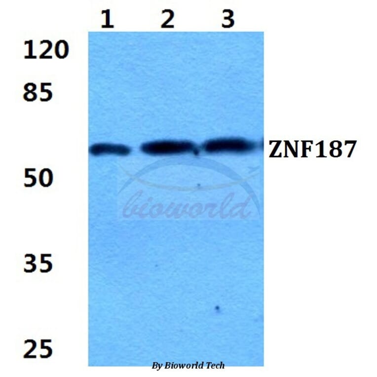 Anti-ZNF187 Antibody from Bioworld Technology (BS5945) - Antibodies.com