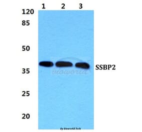 Anti-SSBP2 Antibody from Bioworld Technology (BS5946) - Antibodies.com
