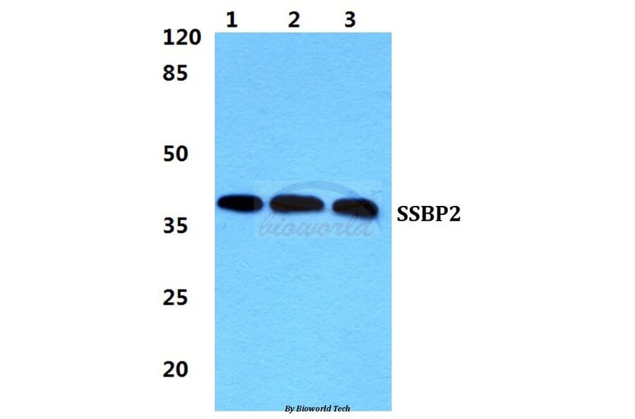 Anti-SSBP2 Antibody from Bioworld Technology (BS5946) - Antibodies.com